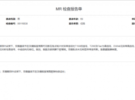 今天的脑MR结果出来的，请大家帮忙看看