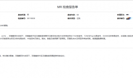 今天的脑MR结果出来的，请大家帮忙看看